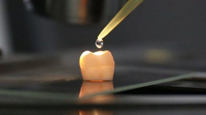 Scientists Develop a Gel That Could Make Tooth Decay a Thing of the Past