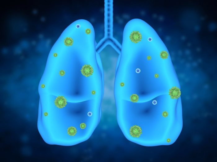 30-Year Study Finds Weekly Use Of Disinfectants Greatly Increases Your Chances Of Lung Disease