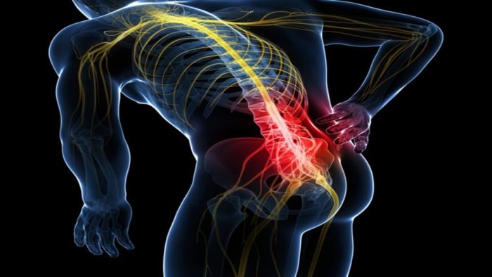 9 Common Causes That Increase Your Risk of Developing Sciatica