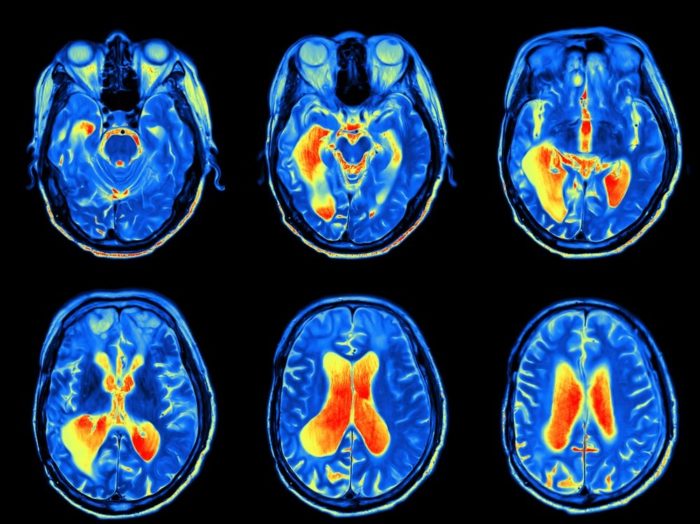 Science Shows What Happens To Your Brain When You Complain Too Much