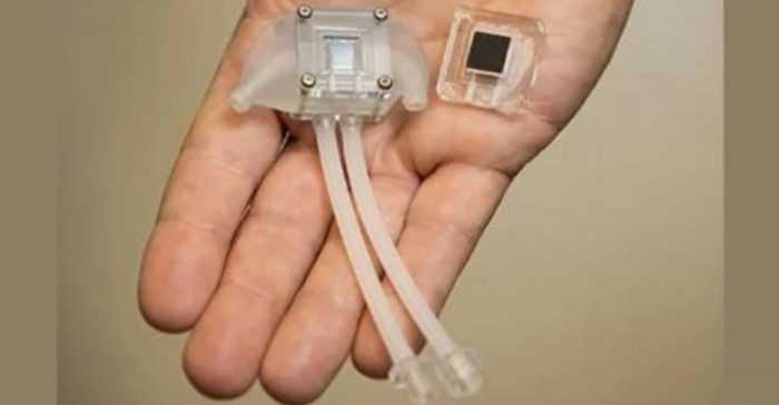 A Bio-Artificial Kidney Is Being Developed To End The Need For Dialysis
