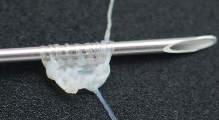 Scientists Grow “Yarn” From Human Flesh So They Can Stitch People Up, Repair Organs