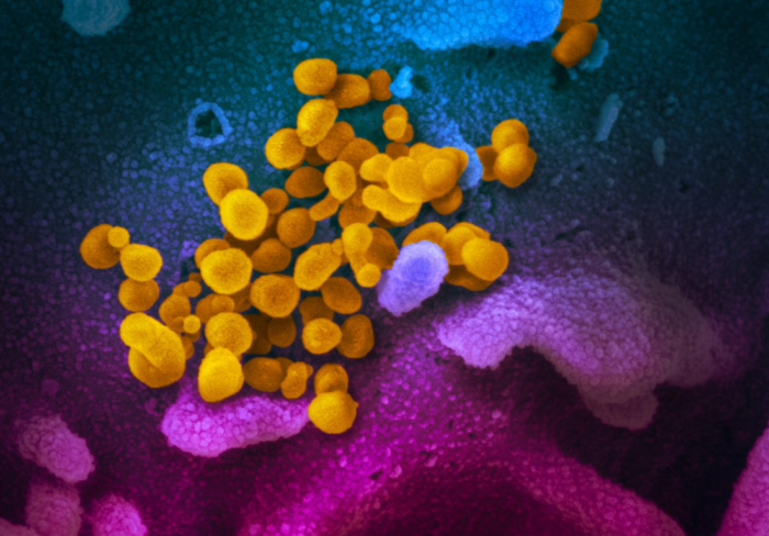 New Coronavirus SARS-CoV-2 Stable for Hours on Surfaces