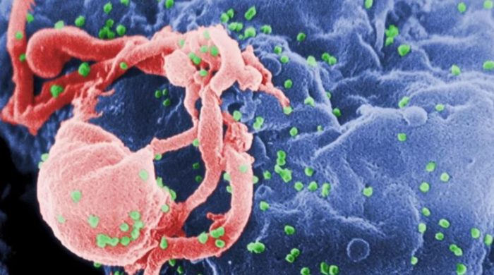 Second Man Cured of HIV After Successful Stem Cell Transplant