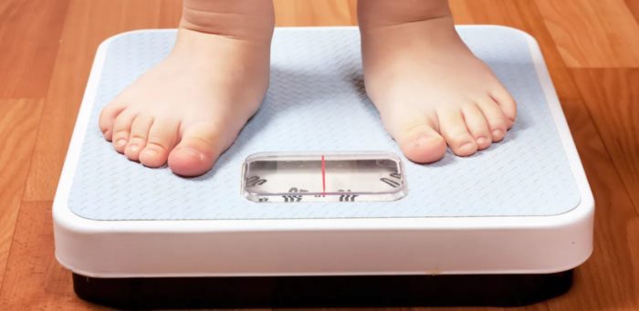 Childhood Obesity Could Increase The Risk of Multiple Sclerosis Later in Life