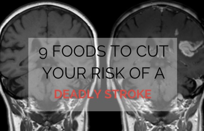 9 Foods to Cut Your Risk of a Deadly Stroke