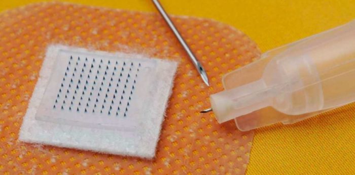 Swansea University Developing Microneedle Smart Patch COVID Vaccine That Can Track Patient Reactions