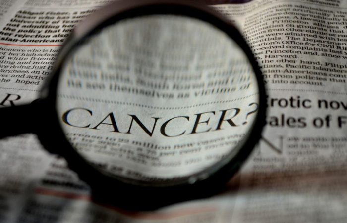 Cancer on the Rise Globally Among Adults Under 50