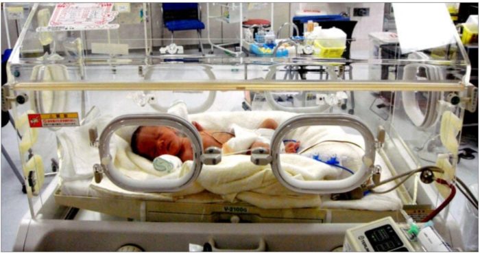 Why Are Toxic Phthalates Still Used in Medical Supplies for Premature Babies?