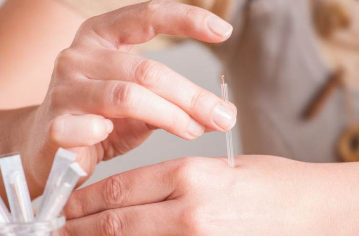 Acupuncture Beats Injected Morphine for Pain: Groundbreaking Study